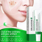 20g Whitening Freckle Cream Remove Dark Spot Cream Anti Freckle and Aging Cream Fade Pigmentation Melasma Brighten Serum Skin