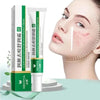 20g Whitening Freckle Cream Remove Dark Spot Cream Anti Freckle and Aging Cream Fade Pigmentation Melasma Brighten Serum Skin